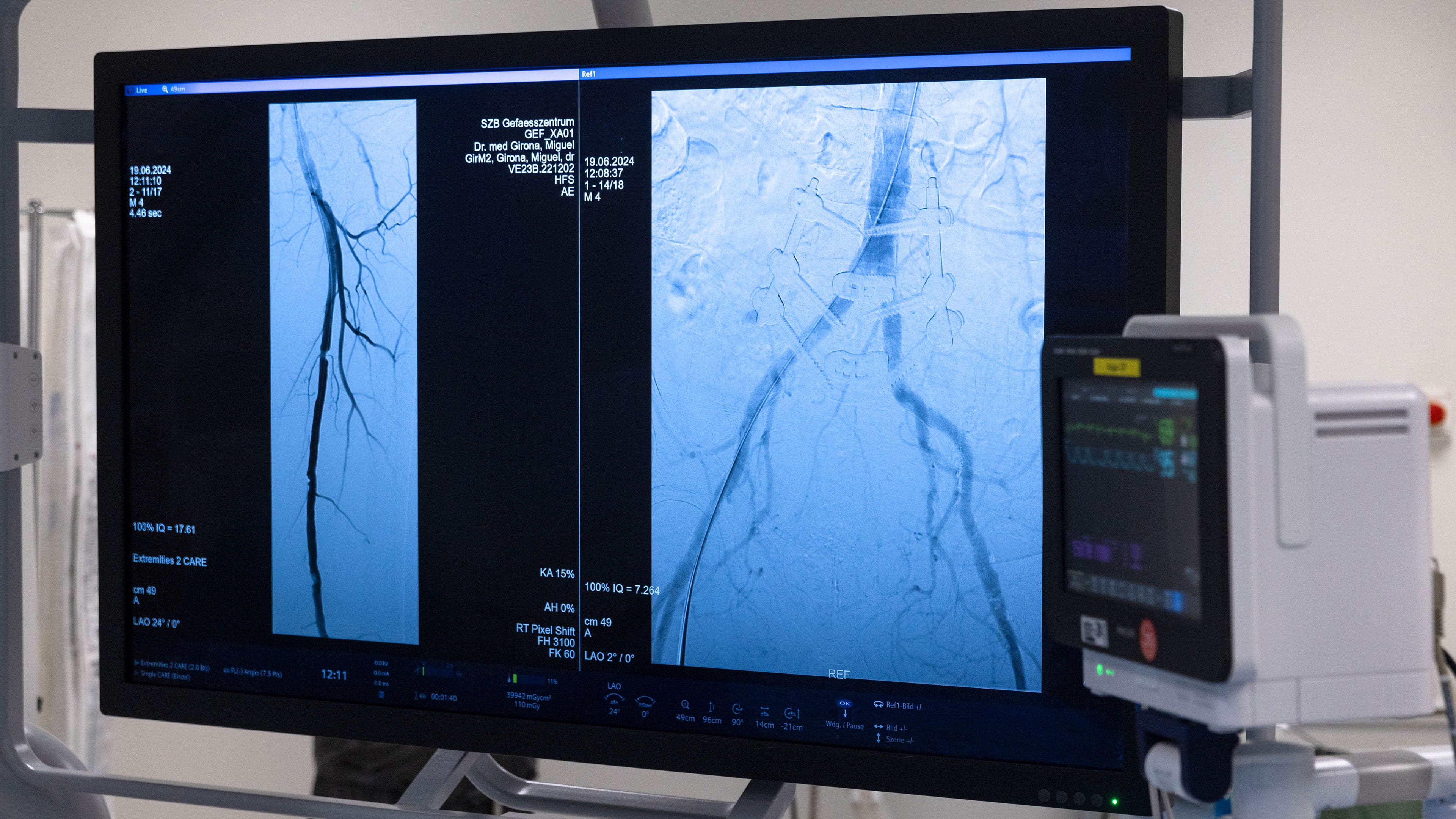 Gefässzentrum OP 3 Min